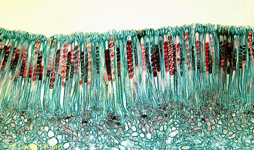 รา ในไฟลัม Ascomycota ส่องด้วยกล้องจุลทรรศน์ (ภาพจาก : Kuhn Photo)