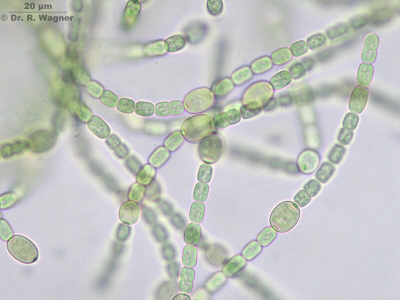 Cyanobacteria กลุ่ม Nostoc และ Anabaena (ภาพจาก : Dr. Ralf Wagner)